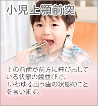 小児上顎前突